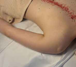 Санаторий «Ерино», фото 94