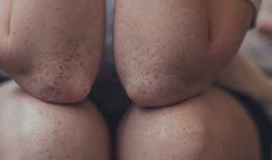 10 программ лечения артроза в санаториях России в 2025 году