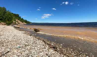 5 недорогих санаториев Татарстана с лечением в 2024 году