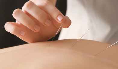 Акупунктура для лечения и реабилитации: польза и где можно пройти