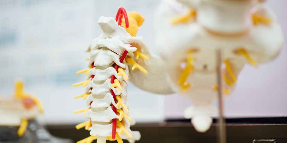 Профилактика грыжи позвоночника