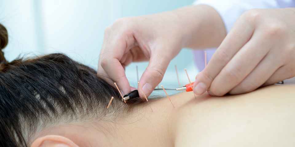 Акупунктура в физиотерапии