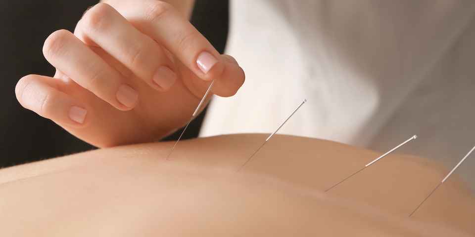 Акупунктура для реабилитации: польза и вред