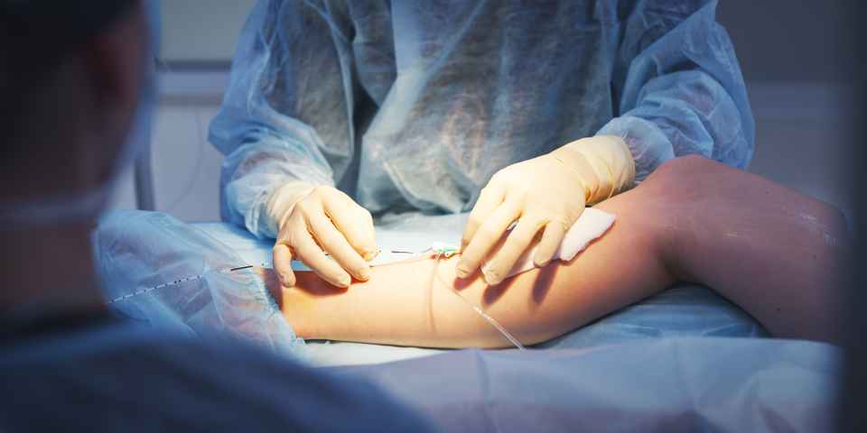 Санатории с лечением варикоза вен